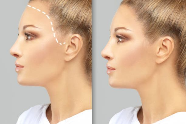 Best FUE/FUT Hair Transplant in Faridabad